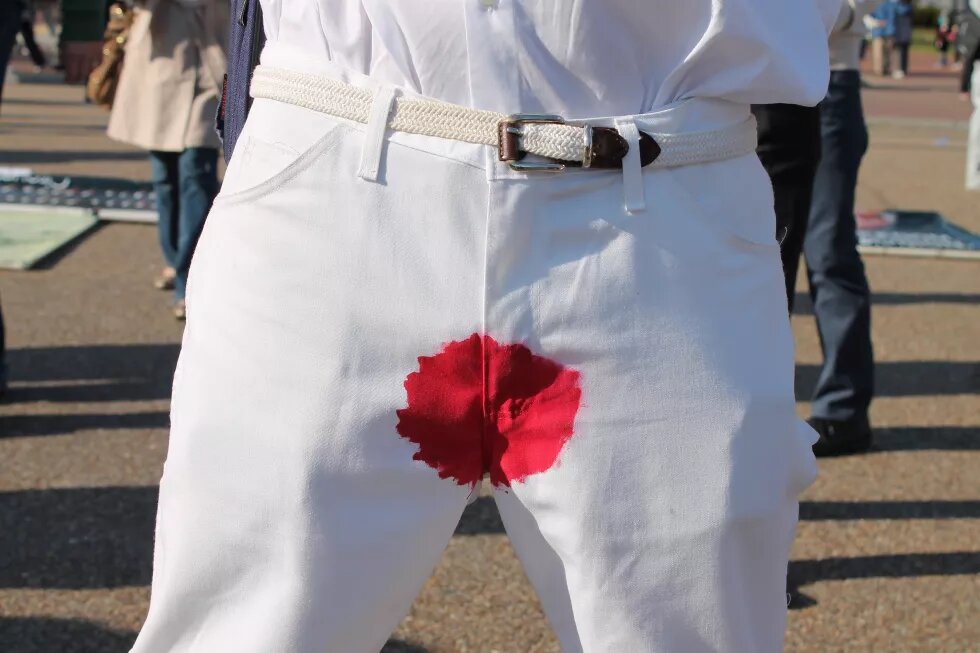 Beschneidung Mann in weißer Hose mit rotem Fleck im Schritt.